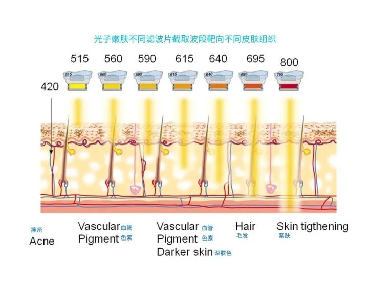 五大光子嫩膚技術(shù)（IPL、DPL、OPT、APT、BBL）及濾光片區(qū)別